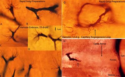 Endothelial Cells Filopodia in the Anastomosis of Central Nervous System Capillaries